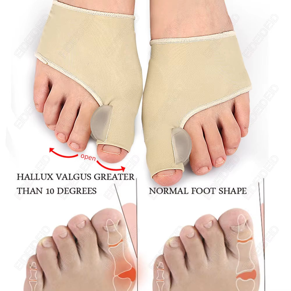 Corrector de juanetes Hallux Valgus Separador de dedos de gel de silicona