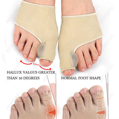 Corrector de juanetes Hallux Valgus Separador de dedos de gel de silicona